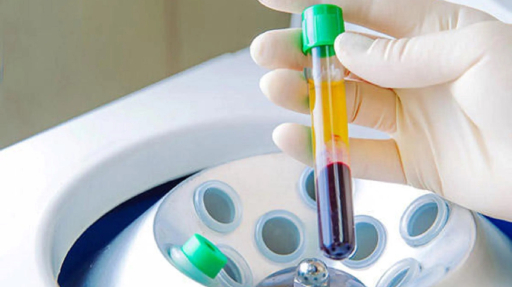 High Dose PRP-1