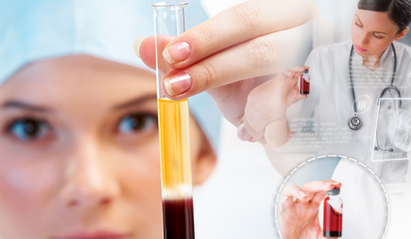 Why Choose PRP Therapy