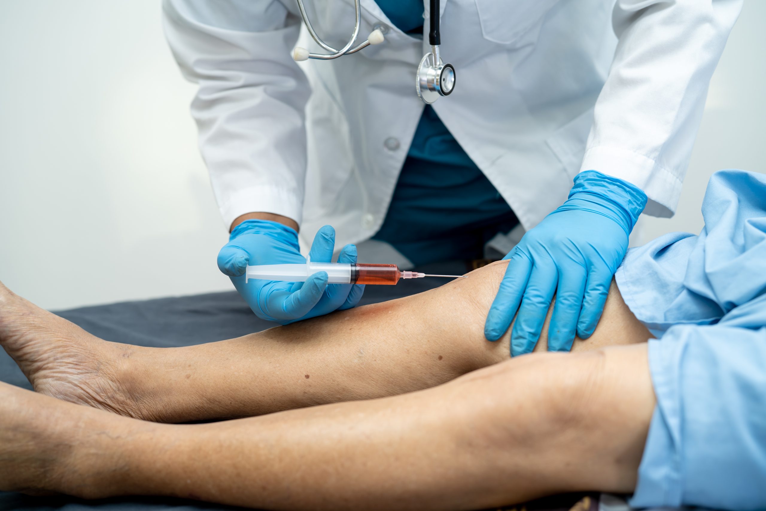 Asian doctor inject Hyaluronic acid platelet rich plasma into th