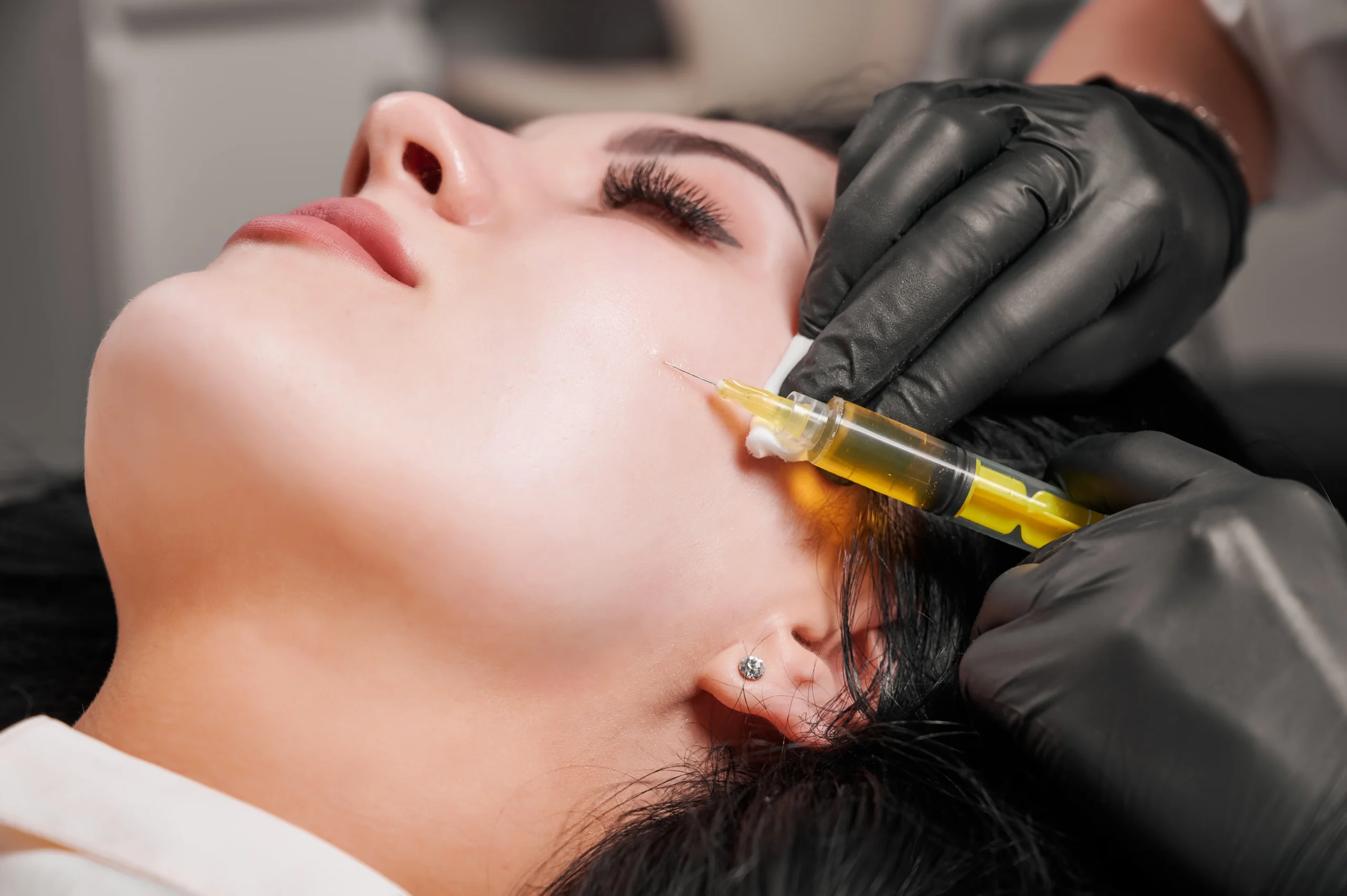 PRP Injection Los Angeles